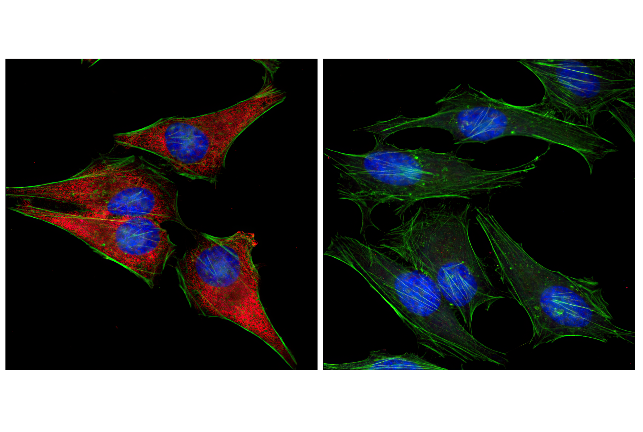 Immunofluorescence Image 2: S6 Ribosomal Protein (5G10) Rabbit mAb (BSA and Azide Free)