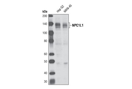 Western Blotting Image 1: NPC1L1 Antibody