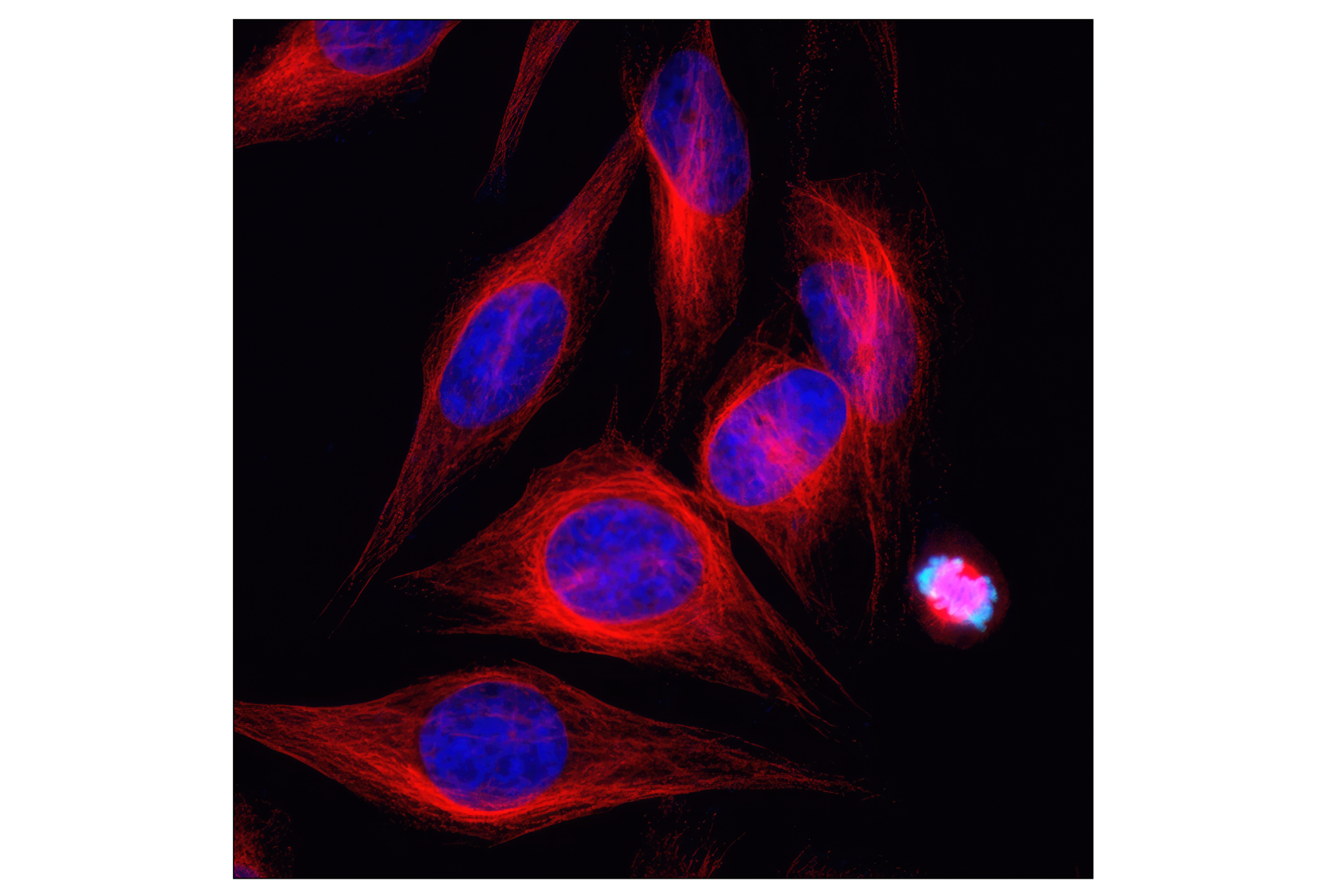 Immunofluorescence Image 1: α-Tubulin (11H10) Rabbit mAb (Alexa Fluor® 555 Conjugate)