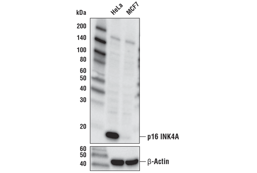Western Blotting Image 1: p16 INK4A (D7C1M) Rabbit mAb (BSA and Azide Free)