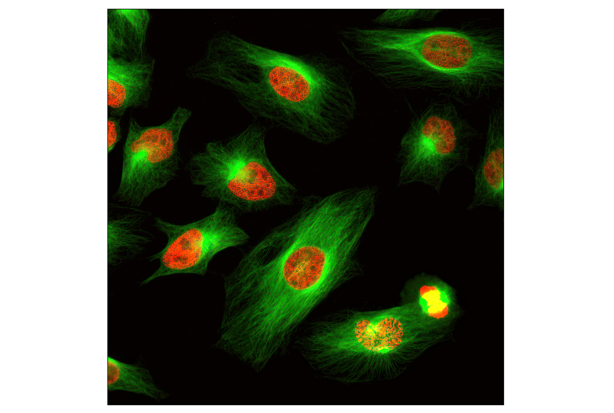 Immunofluorescence Image 1: α-Tubulin (11H10) Rabbit mAb (Alexa Fluor® 488 Conjugate)