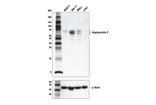 Western Blotting Image 1: Angiopoietin-2 (D200) Antibody