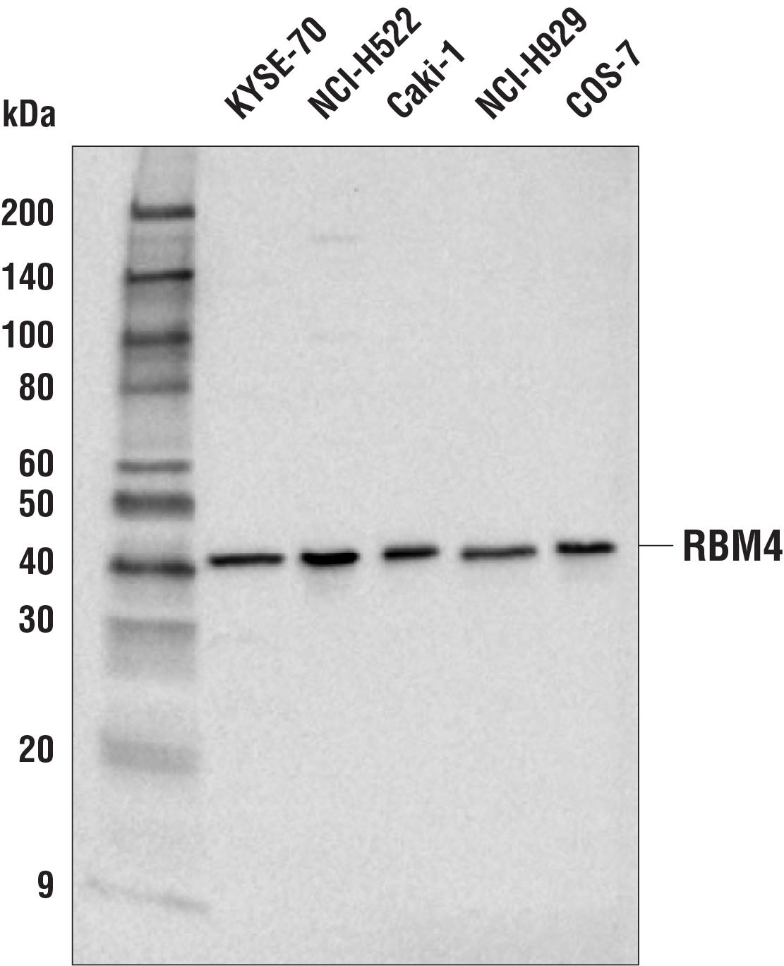 Western Blotting Image 1: RBM4 Antibody
