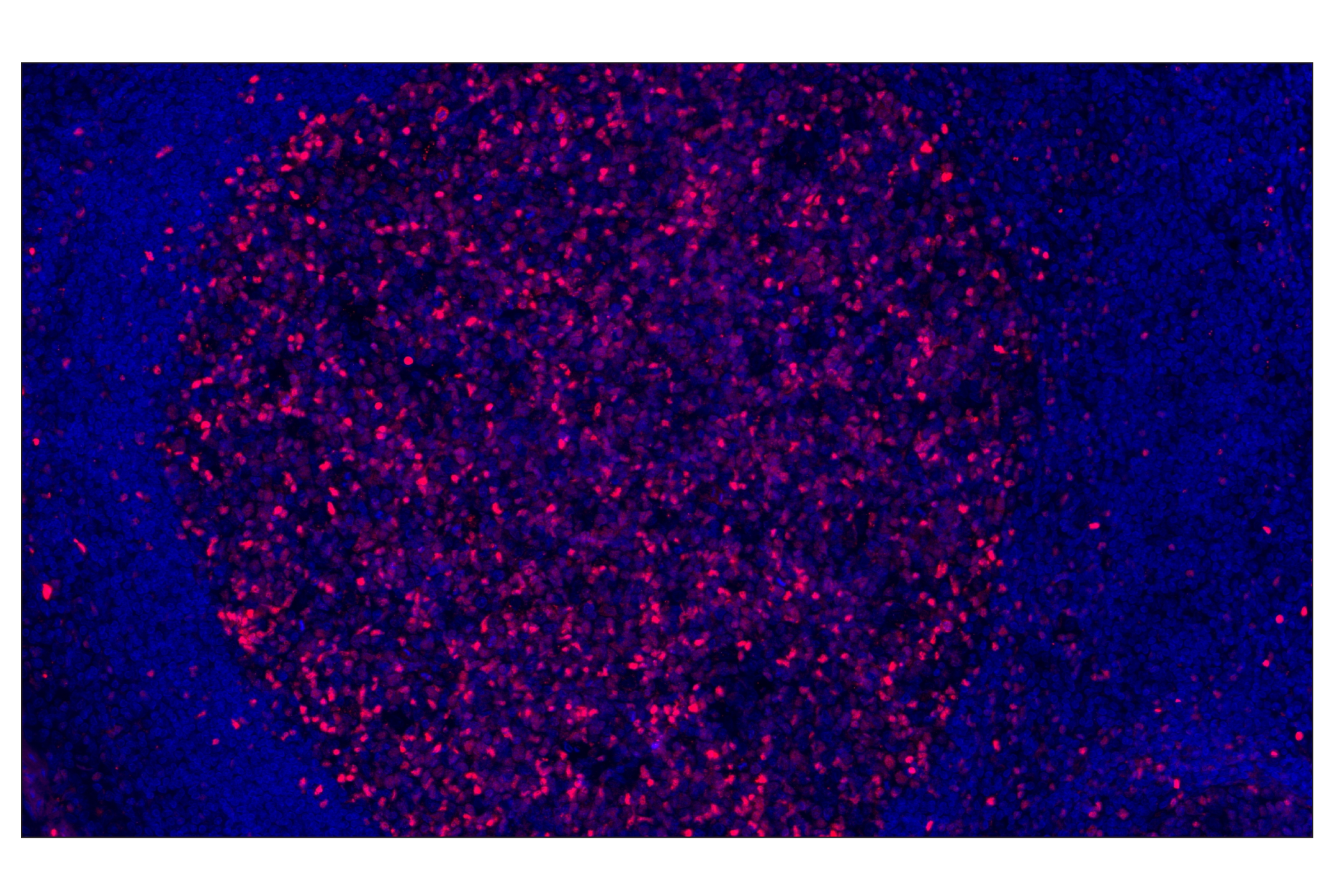 Immunohistochemistry Image 1: Tox/Tox2 (E6I3Q) Rabbit mAb (Alexa Fluor® 555 Conjugate)