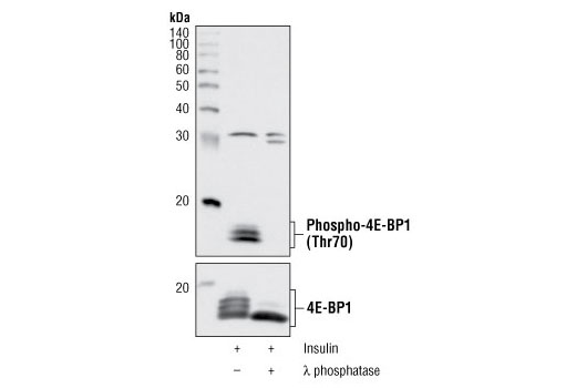 Western Blotting Image 1: Phospho-4E-BP1 (Thr70) II Antibody