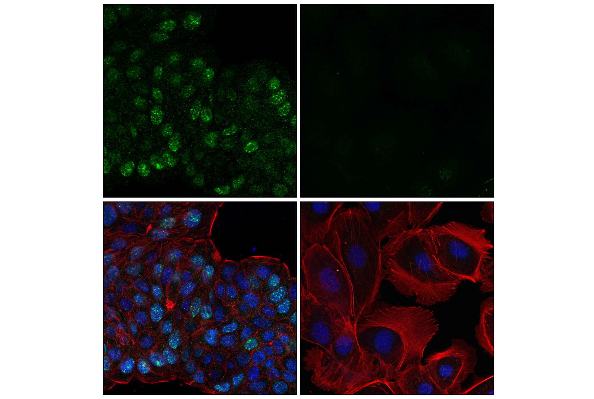 Immunofluorescence Image 1: BRCA1 (E5S9G) Rabbit mAb