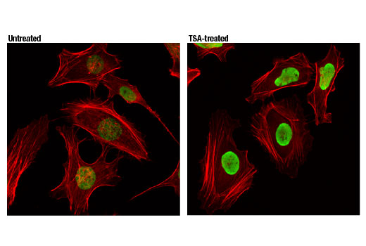 Immunofluorescence Image 1: Acetyl-Histone H4 (Lys12) (D2W6O) Rabbit mAb (BSA and Azide Free)