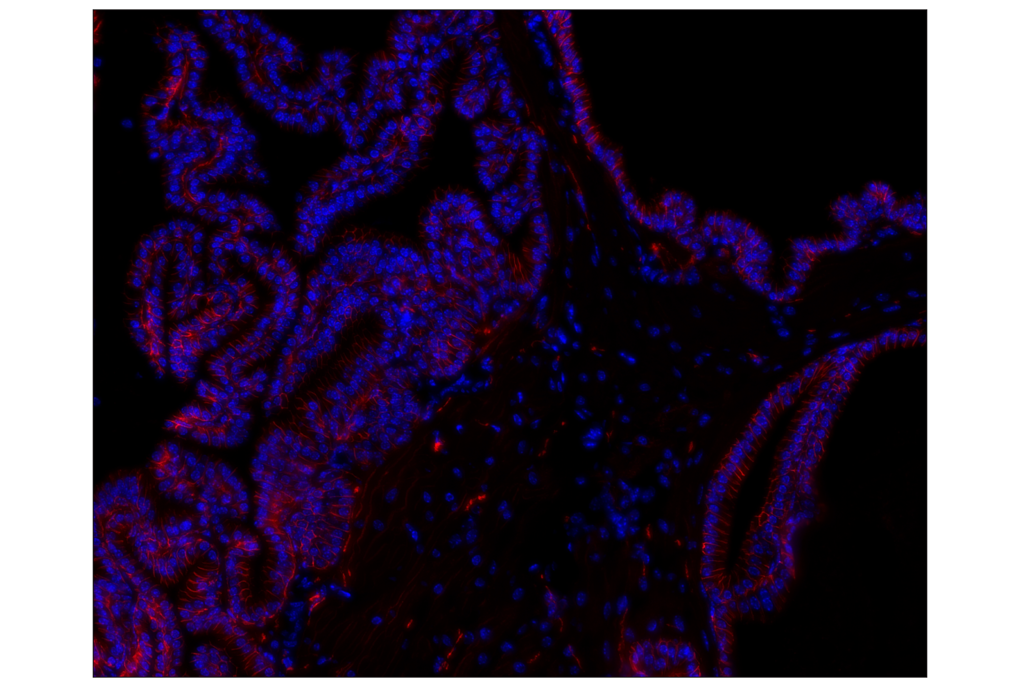 Immunohistochemistry Image 2: NCAM1 (CD56) (E7X9M) XP® Rabbit mAb (Alexa Fluor® 647 Conjugate)