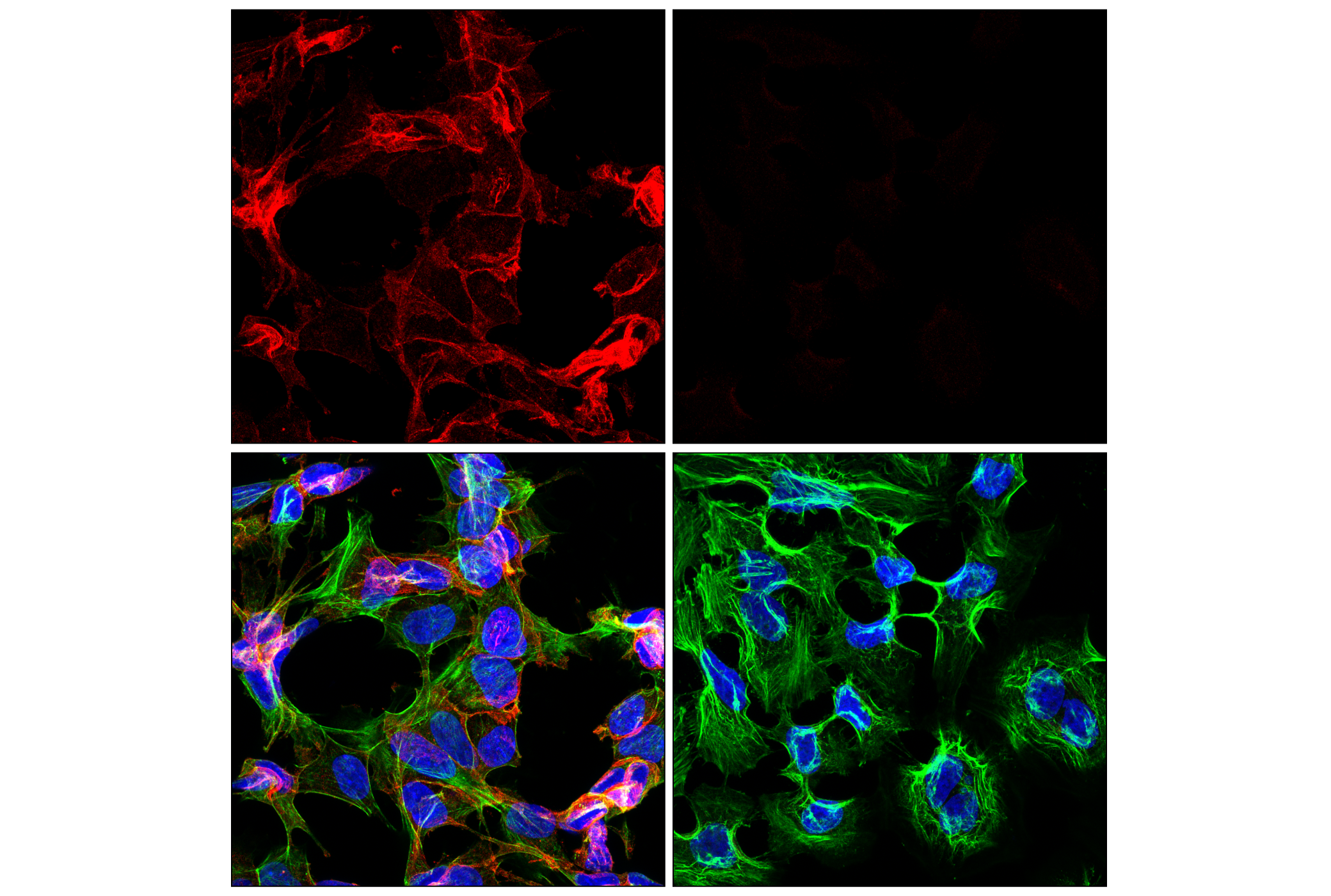 Immunofluorescence Image 2: NCAM1 (CD56) (E7X9M) XP® Rabbit mAb (Alexa Fluor® 647 Conjugate)