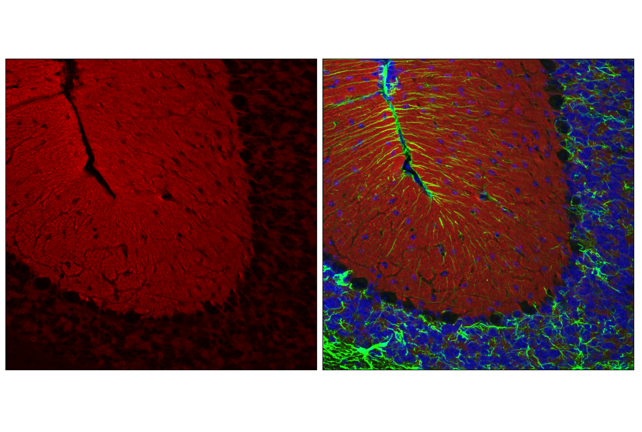 Immunofluorescence Image 1: NCAM1 (CD56) (E7X9M) XP® Rabbit mAb (Alexa Fluor® 647 Conjugate)