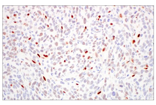 Immunohistochemistry Image 4: TWIST1 (E2M5V) Rabbit mAb