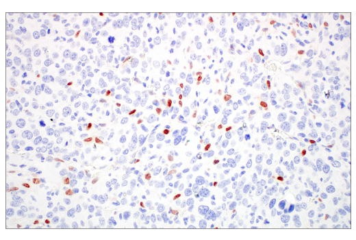 Immunohistochemistry Image 3: TWIST1 (E2M5V) Rabbit mAb