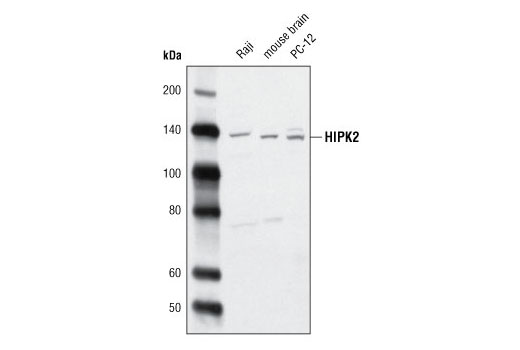 Western Blotting Image 2: HIPK2 Antibody