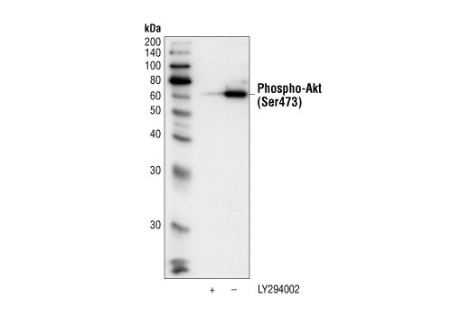 Immunoprecipitation Image 1: Phospho-Akt (Ser473) (587F11) Mouse mAb (Biotinylated)