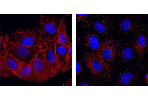 Immunofluorescence Image 1: EGF Receptor (D38B1) XP® Rabbit mAb (Alexa Fluor® 555 Conjugate)
