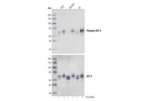  Image 1: PhosphoPlus® ATF-2 (Thr71) Antibody Duet