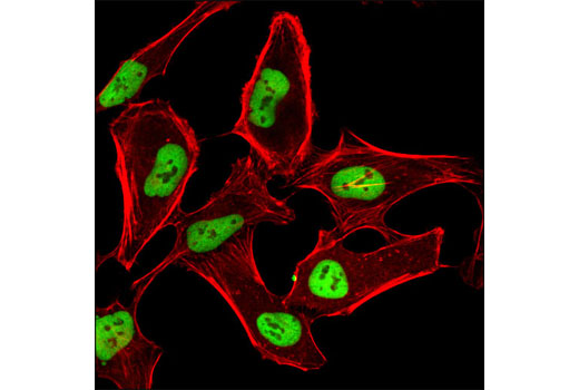 Immunofluorescence Image 1: HDAC2 (3F3) Mouse mAb