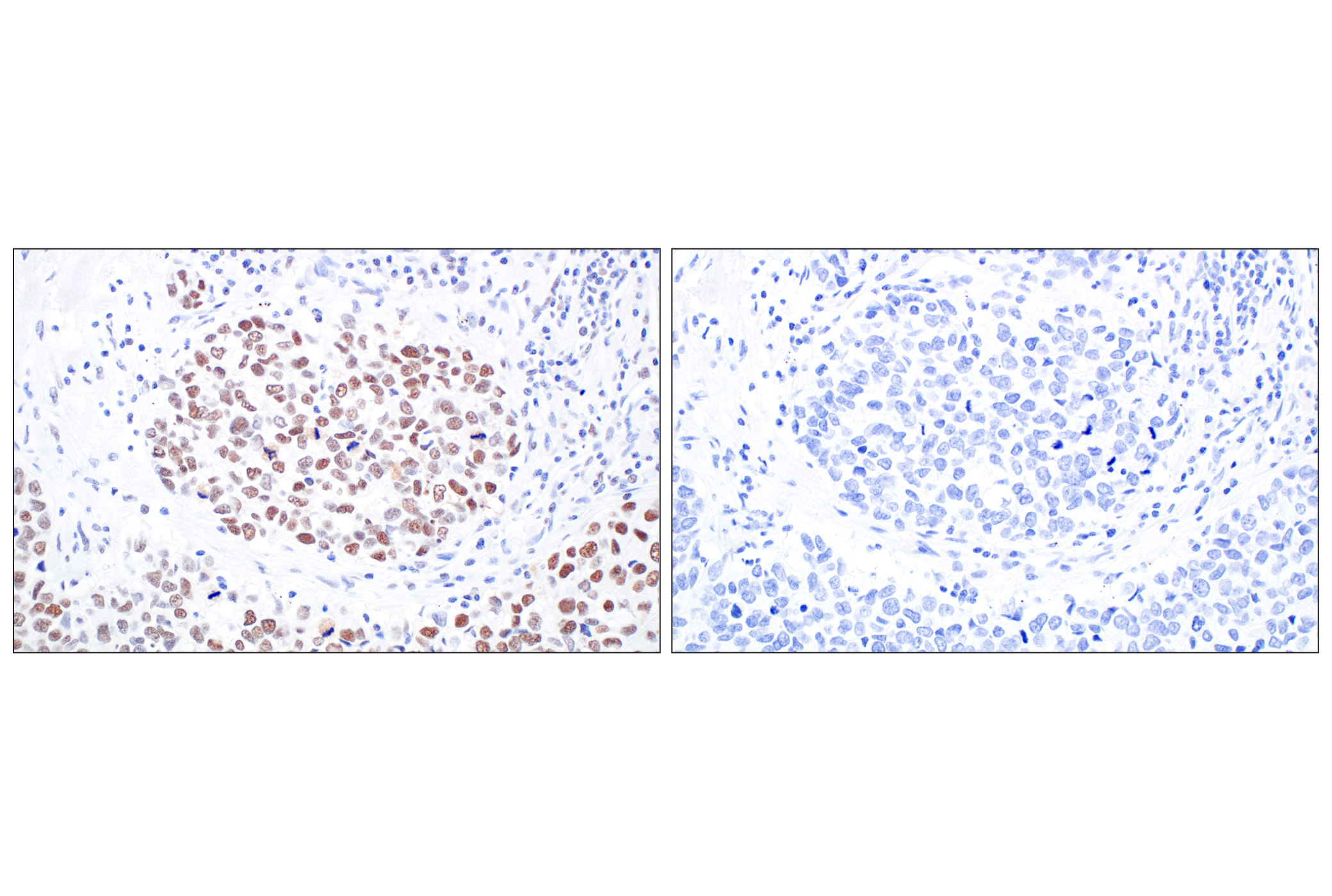 Immunohistochemistry Image 9: HDAC2 (3F3) Mouse Monoclonal Antibody