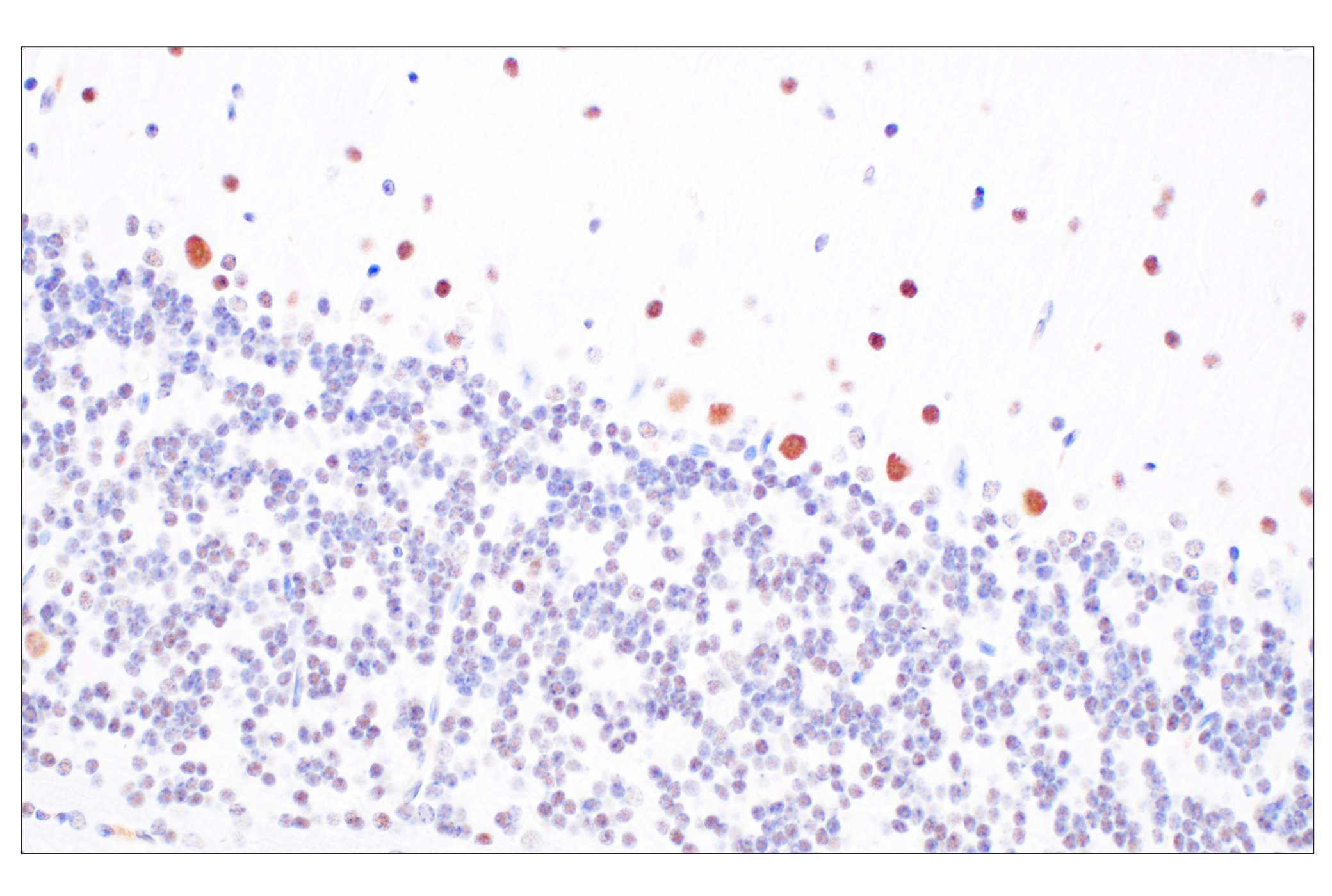 Immunohistochemistry Image 7: HDAC2 (3F3) Mouse Monoclonal Antibody