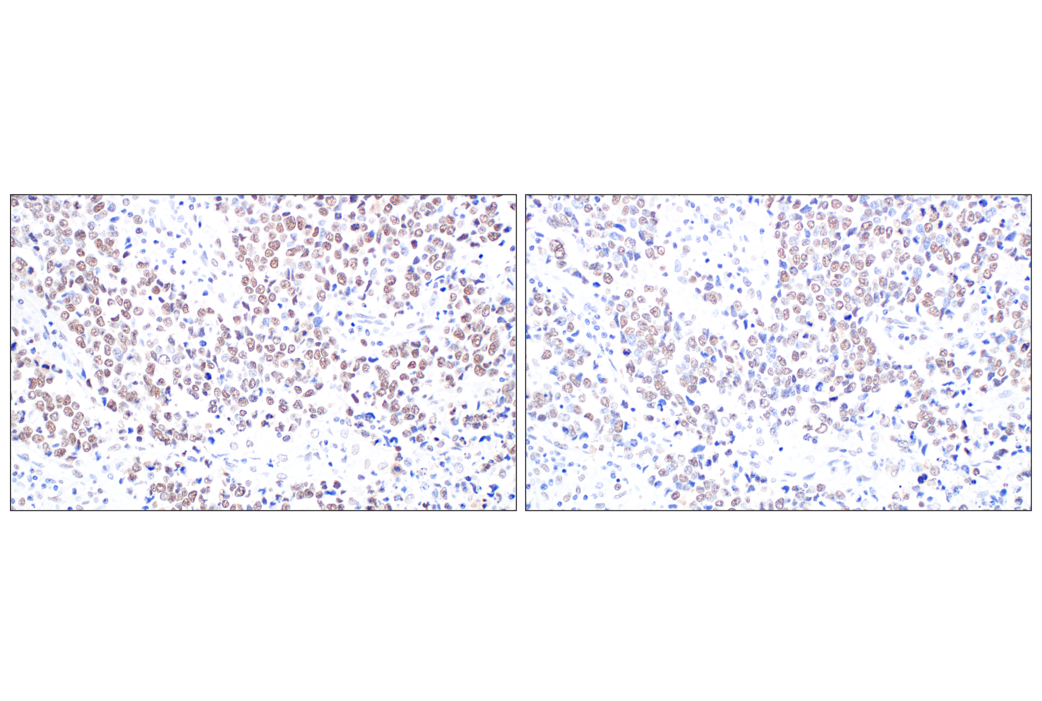 undefined Image 20: NuRD Complex Antibody Sampler Kit