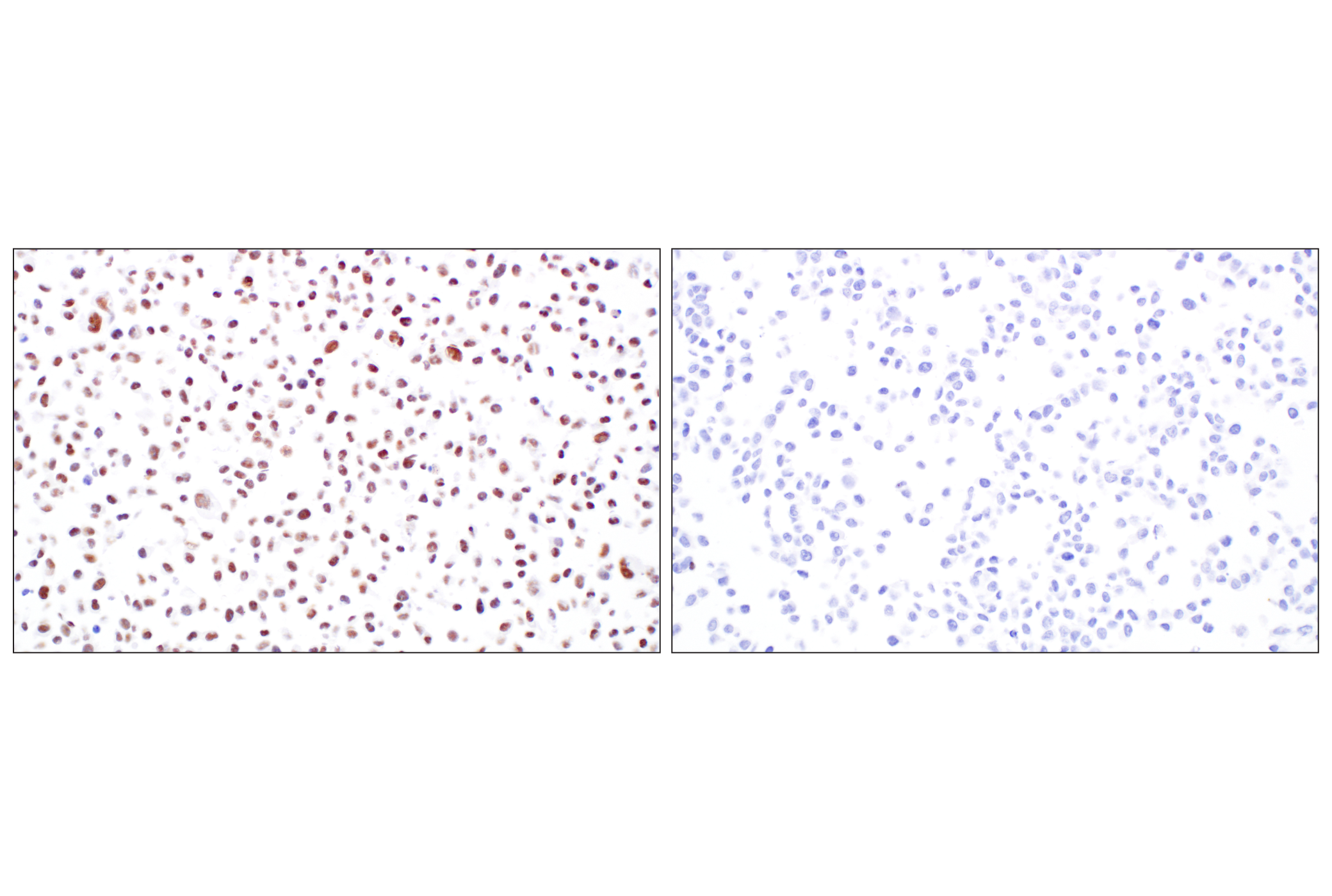 undefined Image 22: NuRD Complex Antibody Sampler Kit
