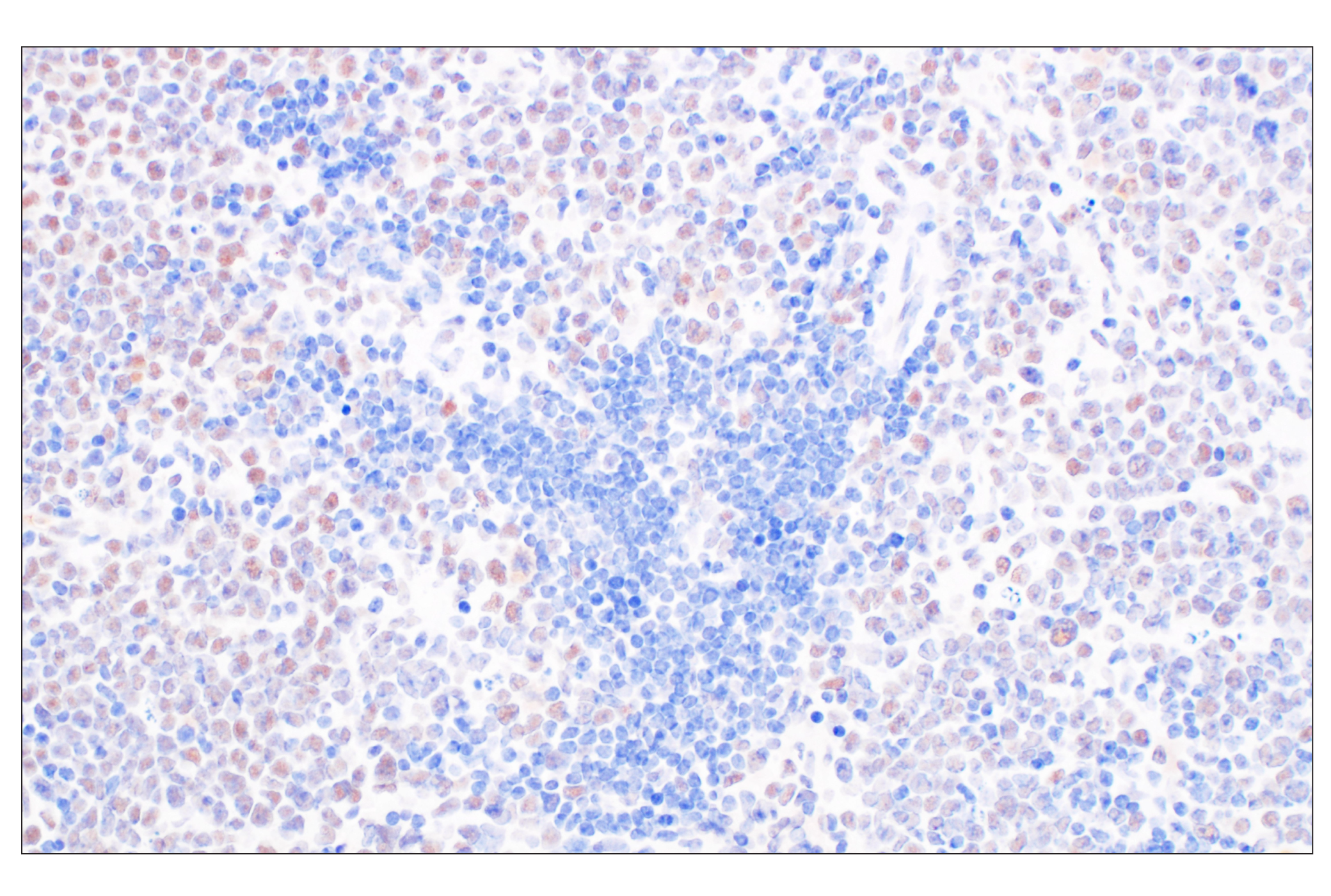 undefined Image 18: NuRD Complex Antibody Sampler Kit