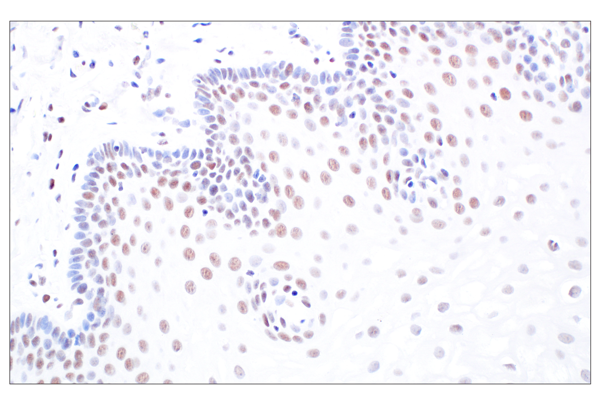 Immunohistochemistry Image 4: HDAC2 (3F3) Mouse Monoclonal Antibody