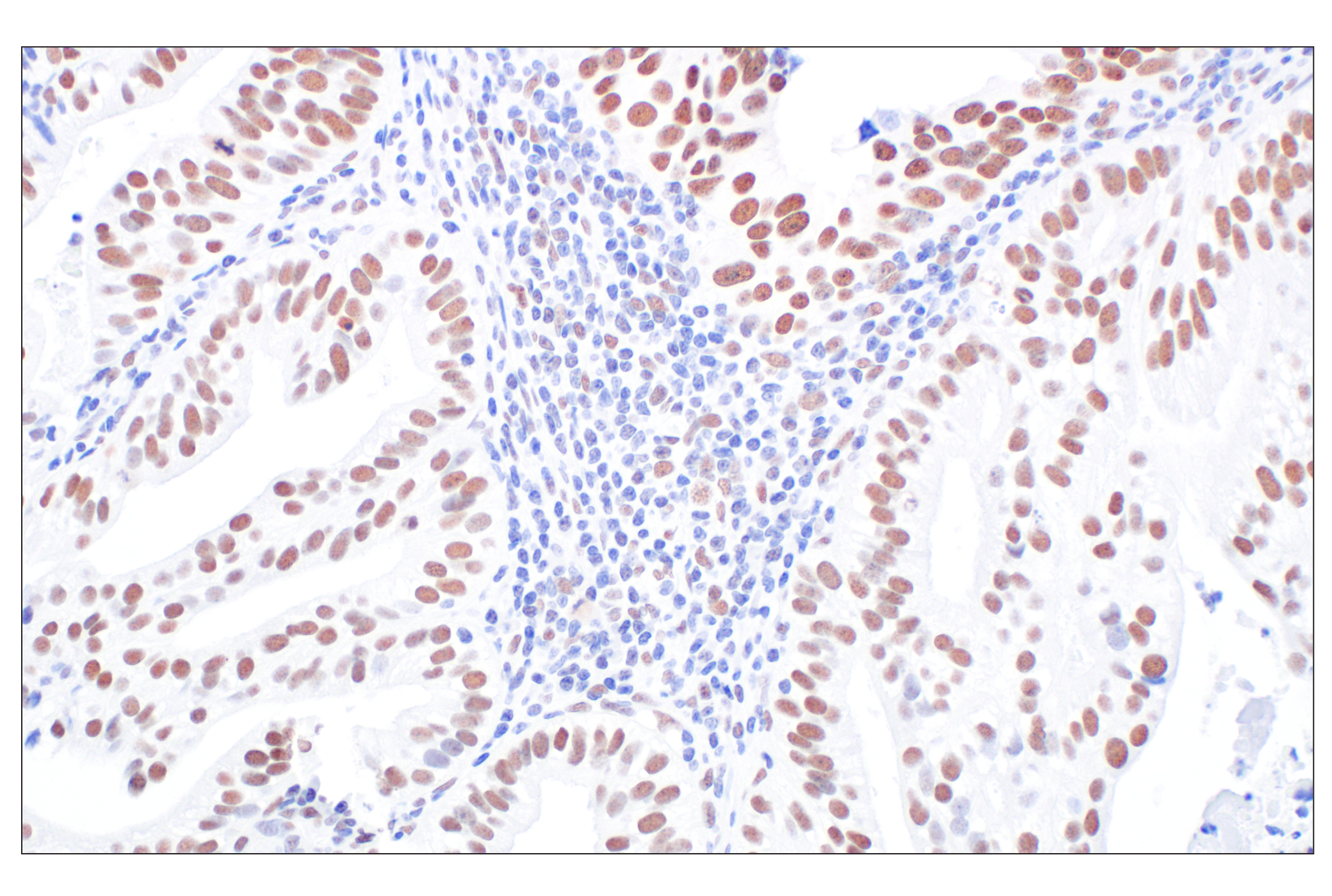 undefined Image 11: NuRD Complex Antibody Sampler Kit