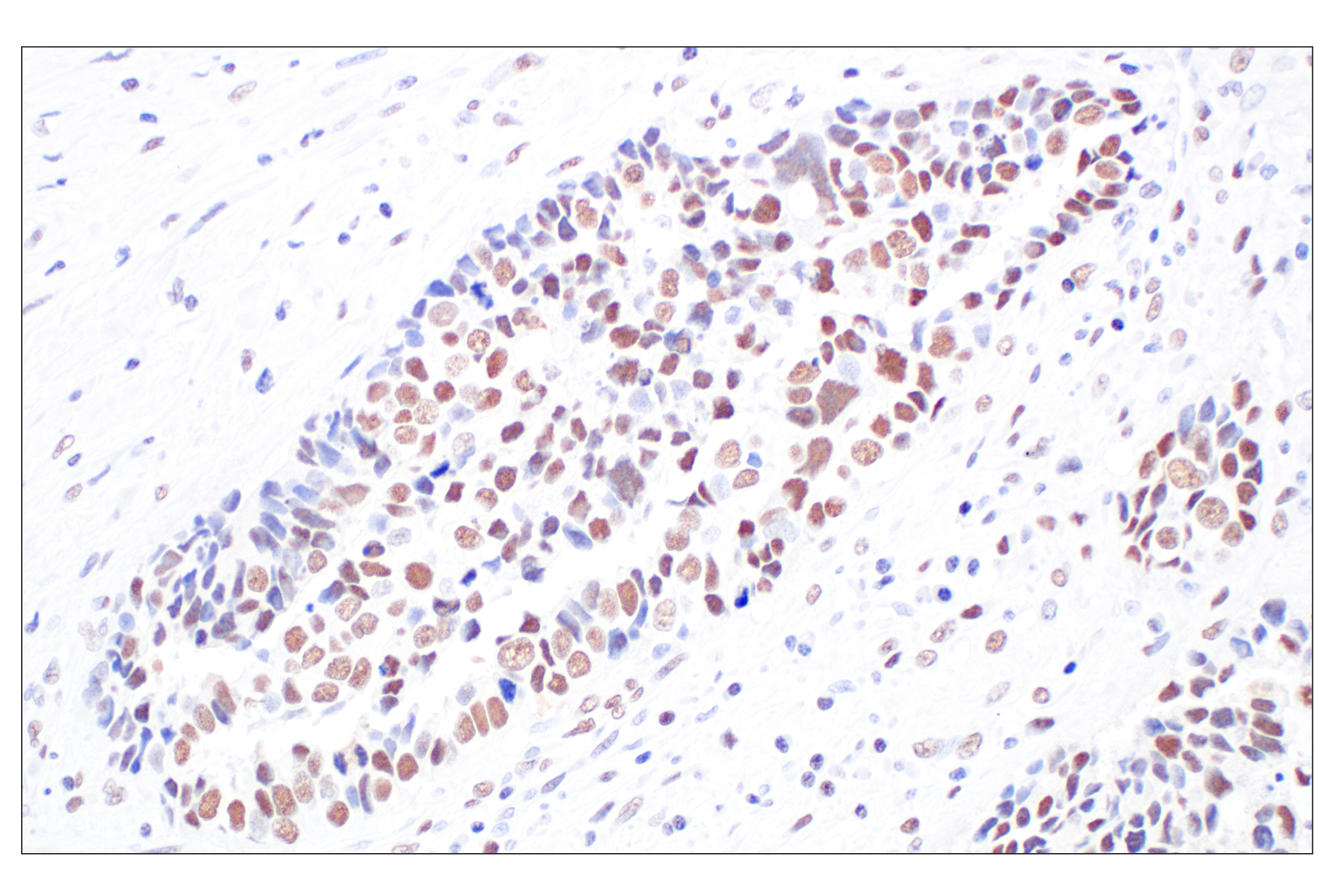 Immunohistochemistry Image 1: HDAC2 (3F3) Mouse Monoclonal Antibody