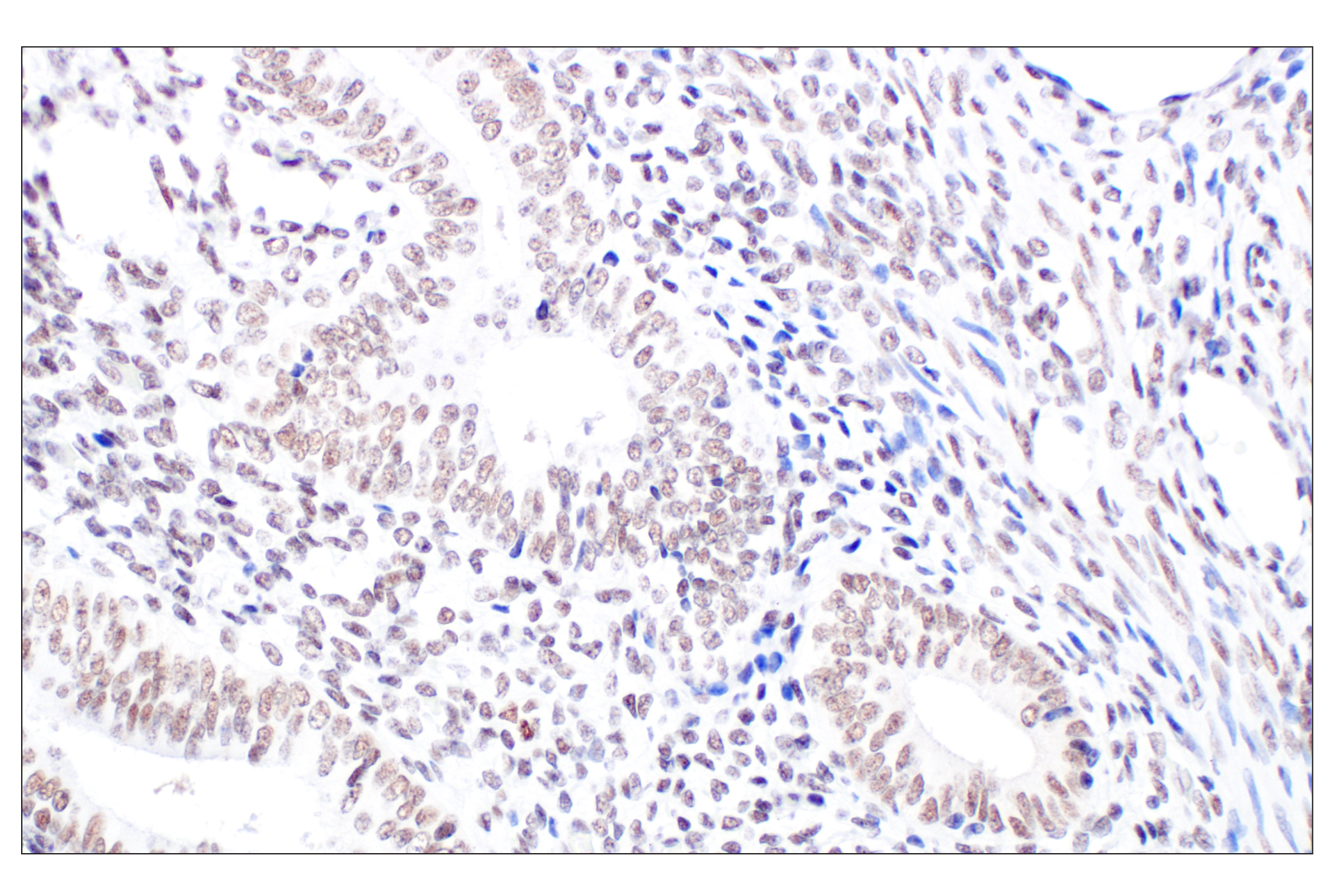 Immunohistochemistry Image 5: HDAC2 (3F3) Mouse Monoclonal Antibody