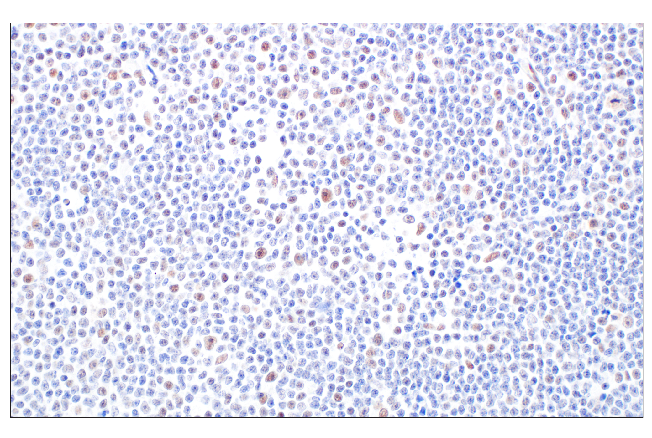 undefined Image 14: NuRD Complex Antibody Sampler Kit