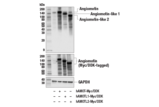 Western Blotting Image 2: Angiomotin (E3E7X) Rabbit mAb