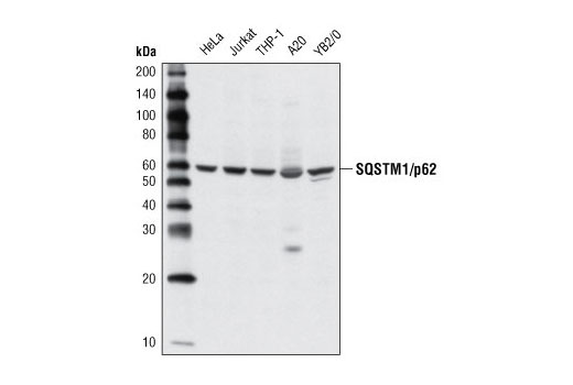 Western Blotting Image 1: SQSTM1/p62 Antibody