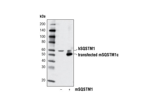 Western Blotting Image 2: SQSTM1/p62 Antibody
