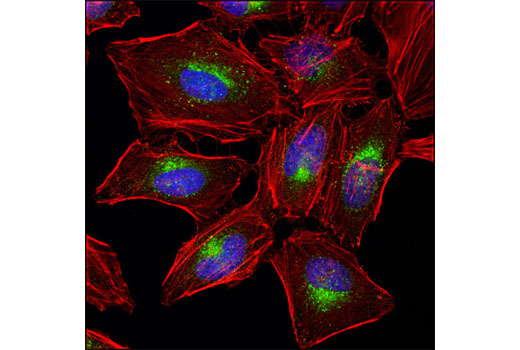 Immunofluorescence Image 1: Rab9A (D52G8) XP® Rabbit mAb
