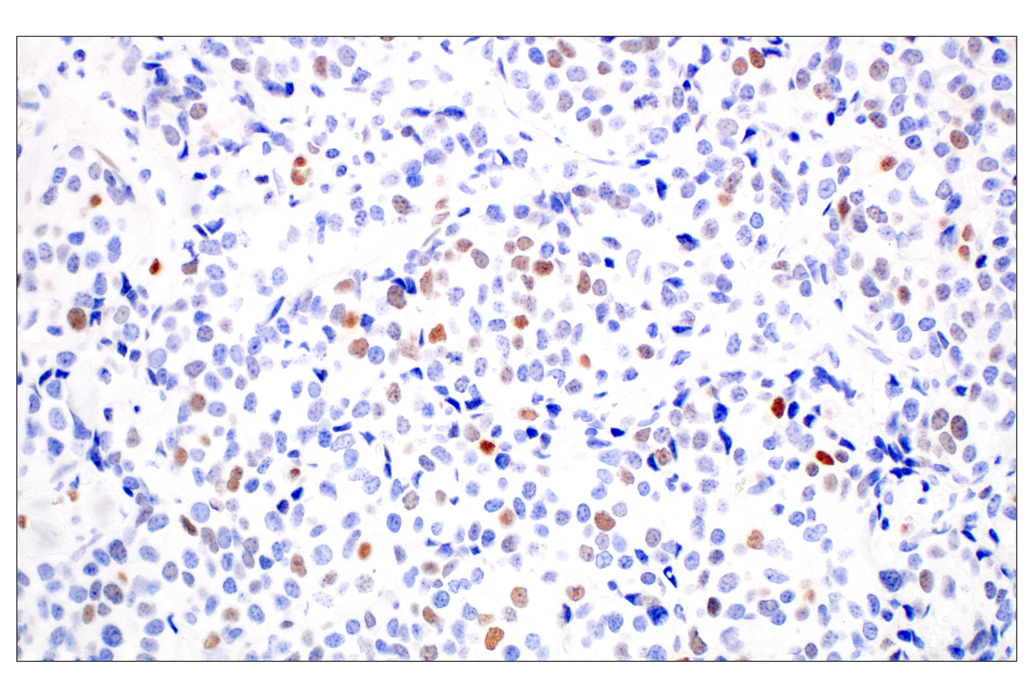 Immunohistochemistry Image 2: KLF2 (E7K8Y) Rabbit mAb