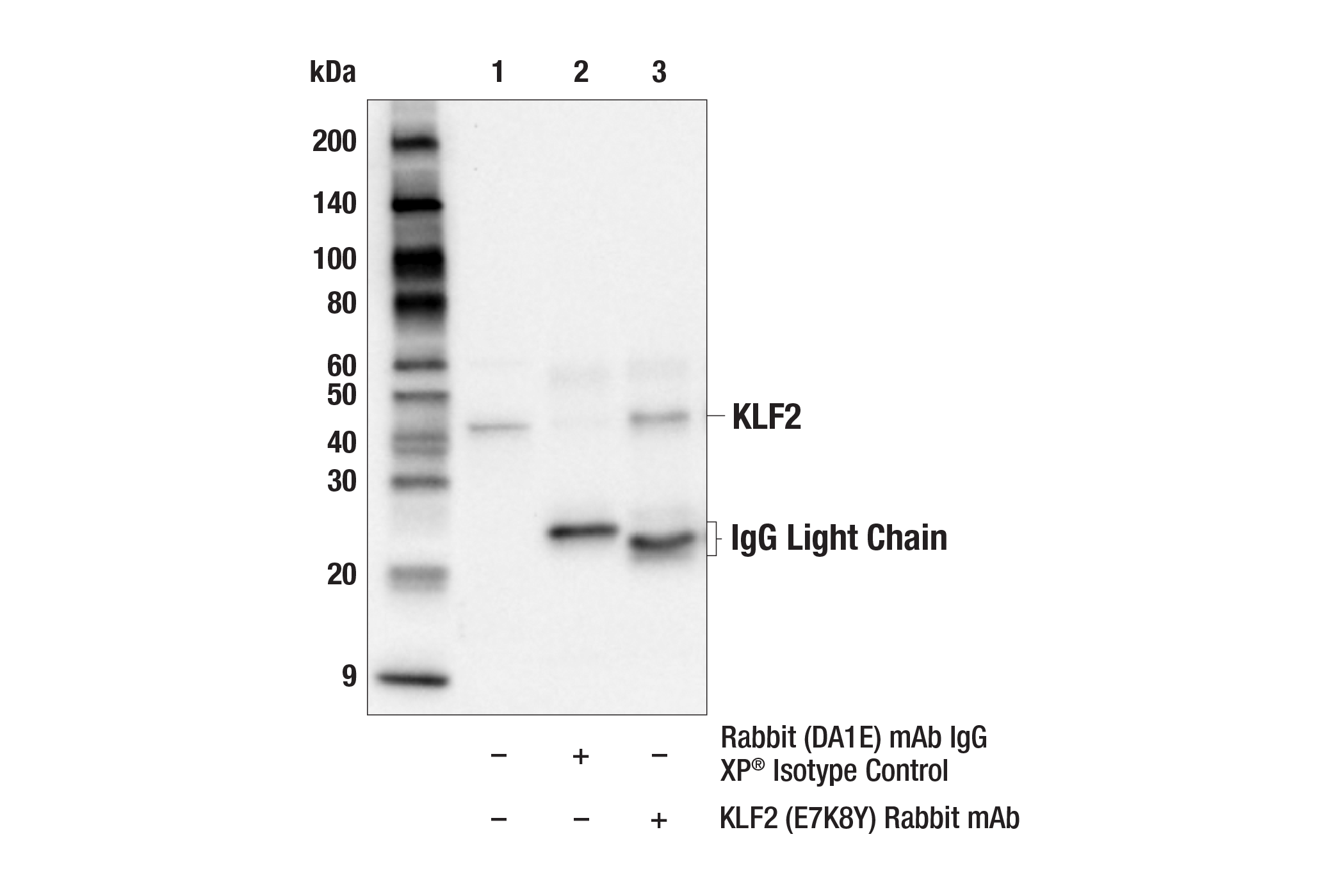 Immunoprecipitation Image 1: KLF2 (E7K8Y) Rabbit mAb