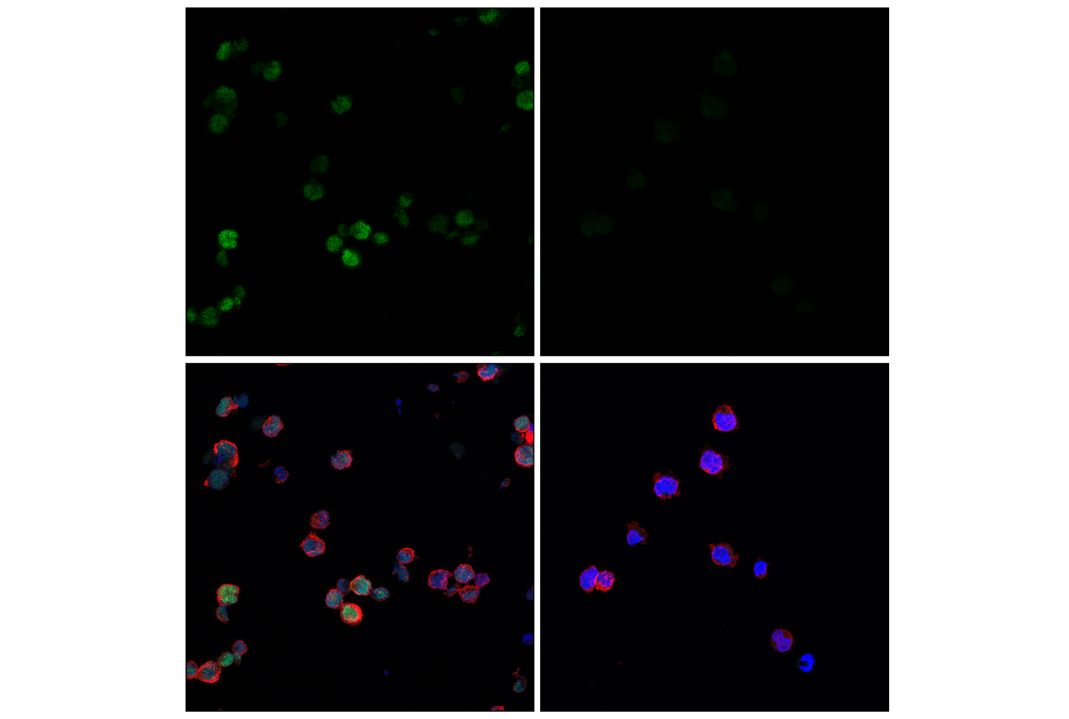 Immunofluorescence Image 1: KLF2 (E7K8Y) Rabbit mAb
