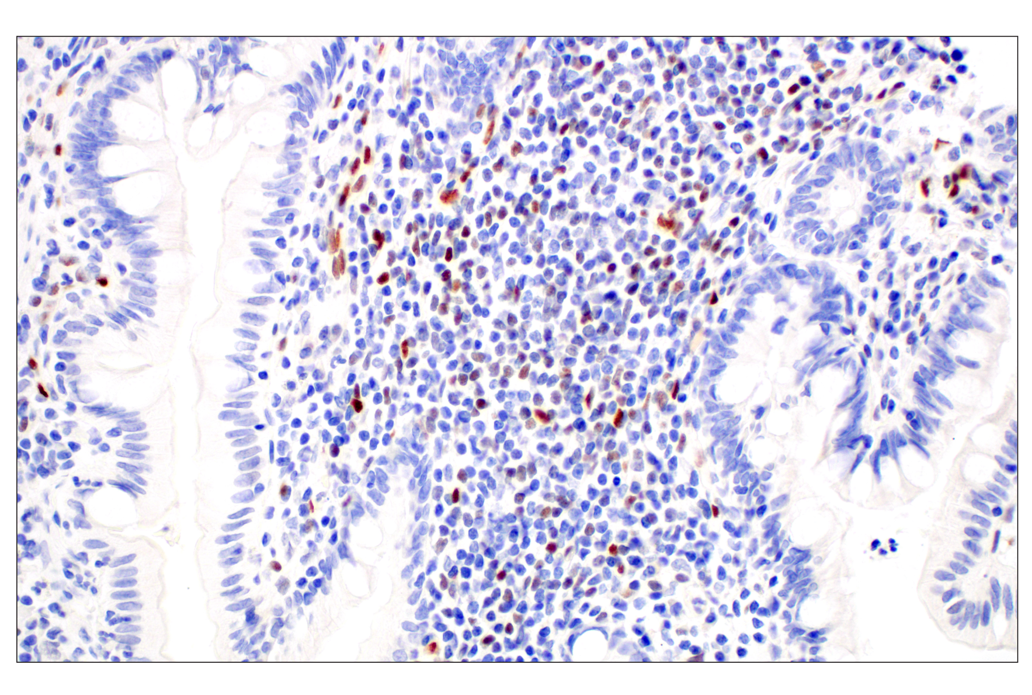 Immunohistochemistry Image 5: KLF2 (E7K8Y) Rabbit mAb