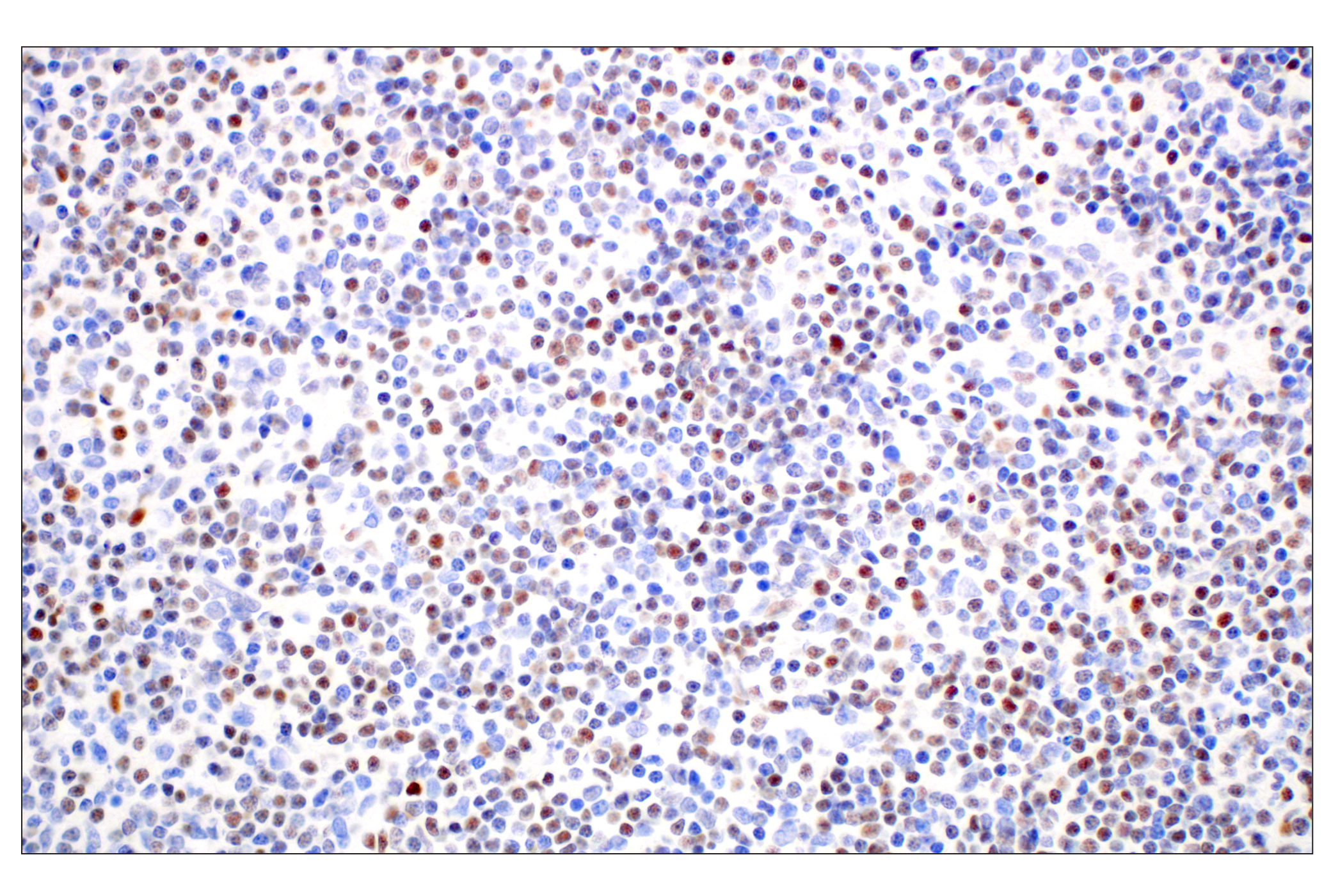 Immunohistochemistry Image 1: KLF2 (E7K8Y) Rabbit mAb