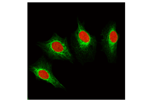 Immunofluorescence Image 1: Keratin 8/18 (C51) Mouse mAb (BSA and Azide Free)