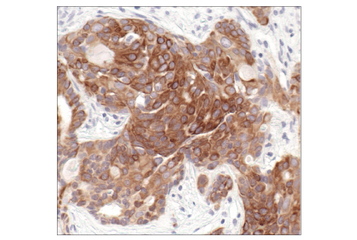 Immunohistochemistry Image 3: Keratin 8/18 (C51) Mouse mAb (BSA and Azide Free)