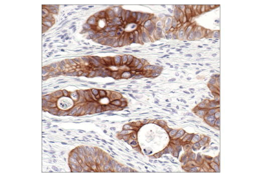 Immunohistochemistry Image 4: Keratin 8/18 (C51) Mouse mAb (BSA and Azide Free)
