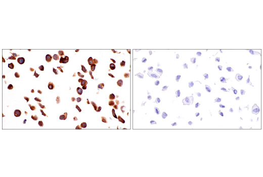 Immunohistochemistry Image 8: CEACAM6 (E7S7Y) Rabbit mAb (BSA and Azide Free)