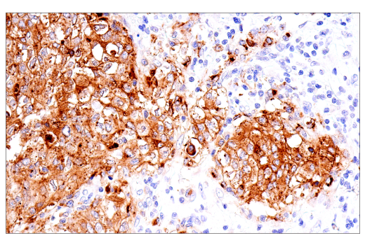Immunohistochemistry Image 2: CEACAM6 (E7S7Y) Rabbit mAb (BSA and Azide Free)