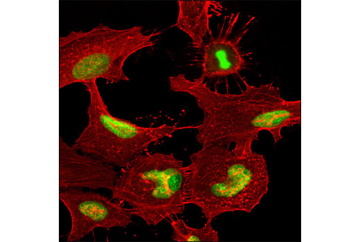 Immunofluorescence Image 1: RCC1 (D15H6) Rabbit mAb