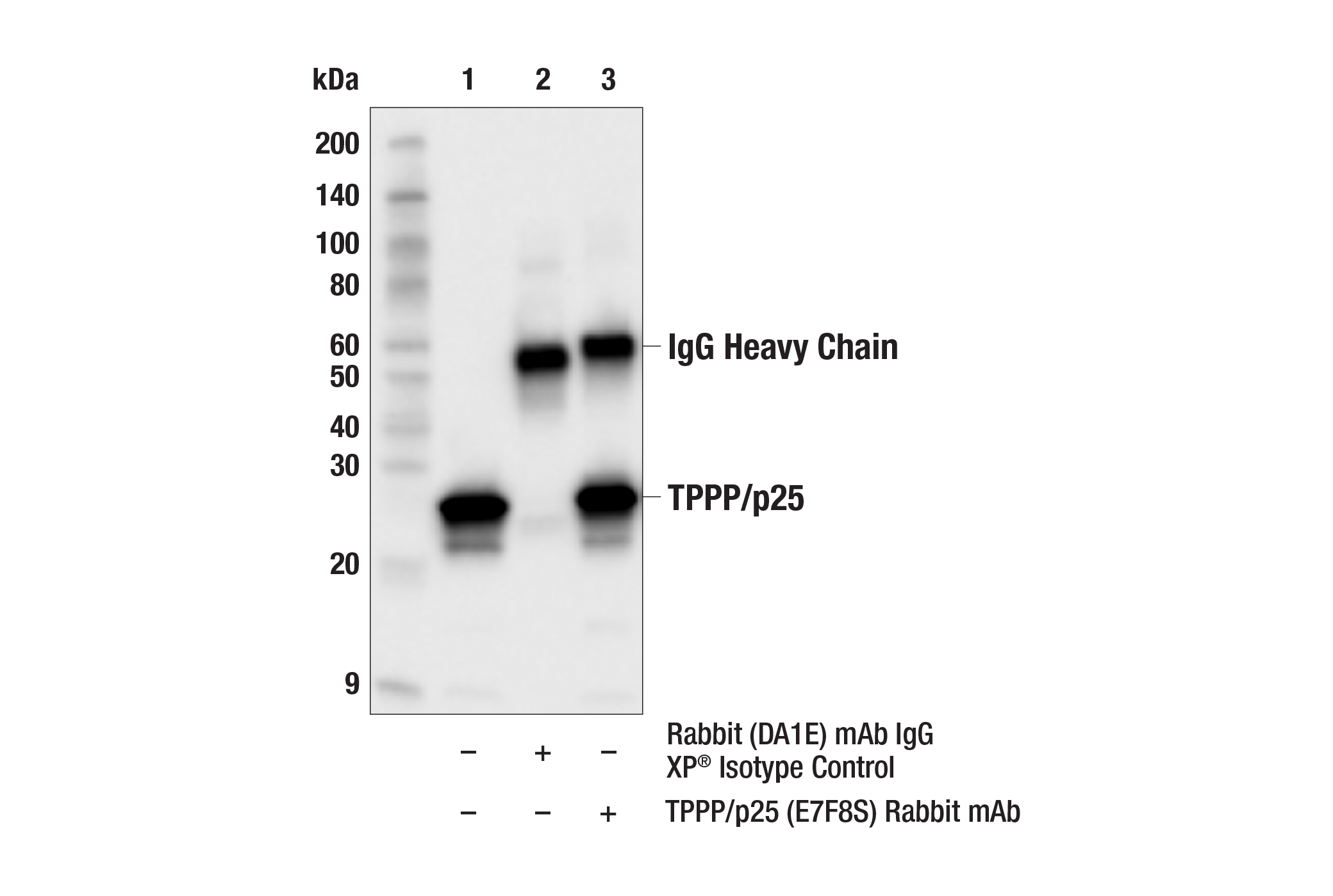 Immunoprecipitation Image 1: TPPP/p25 (E7F8S) Rabbit mAb