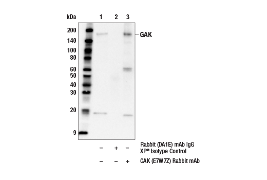 Immunoprecipitation Image 1: GAK (E7W7Z) Rabbit mAb