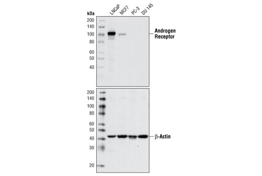  Image 2: PhosphoPlus® Androgen Receptor (Ser258) Antibody Duet