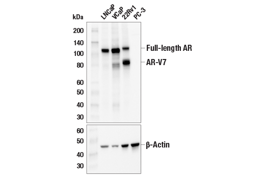  Image 1: PhosphoPlus® Androgen Receptor (Ser258) Antibody Duet